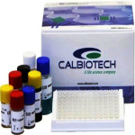 Calbiotech Immunoglobulin E (IgE) ELISA